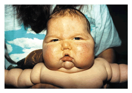 fat ugly baby pictures. fat ugly baby pictures.
